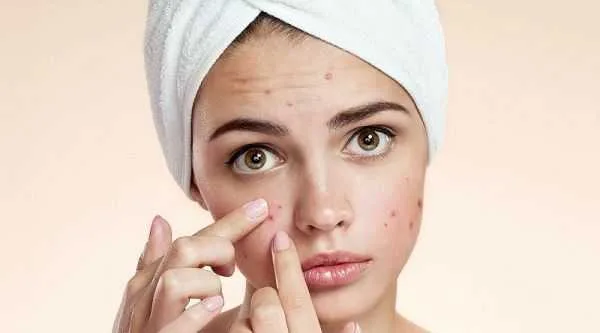 بعد از اصلاح صورت چه کنیم جوش نزنیم؟