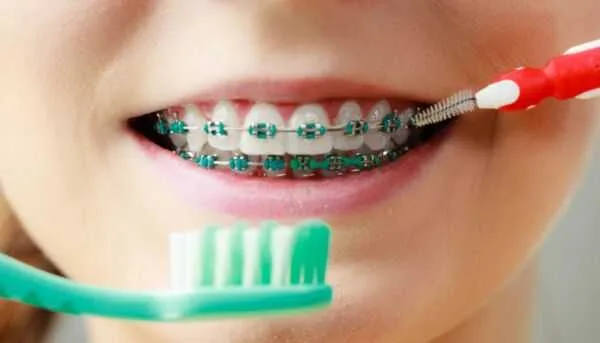 چه وقت باید دندانمان را ارتودنسی  کنیم؟