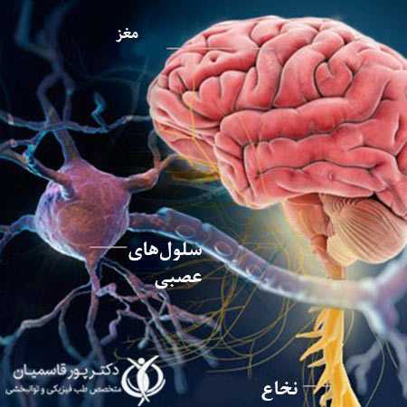 علائم بیماری ام اس چیست؟