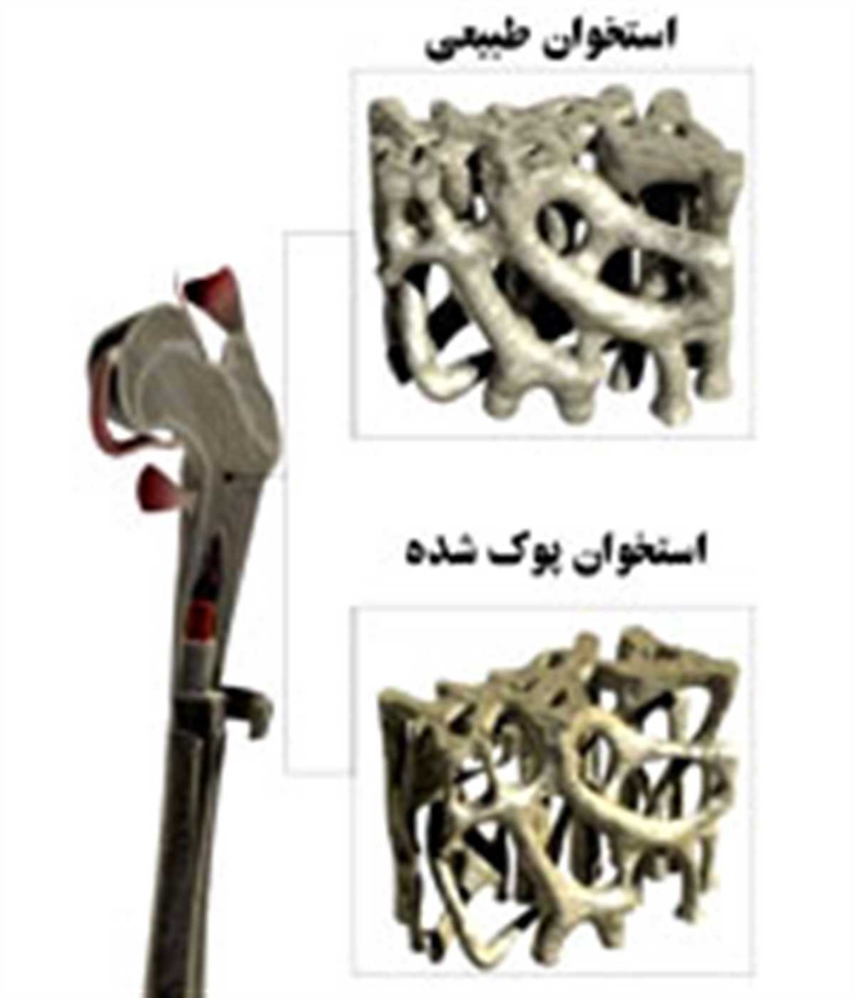 عوارض کمبود کلسیم