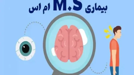 امید بیماران ام اس؛داشتن آینده روشن و زندگی عادی