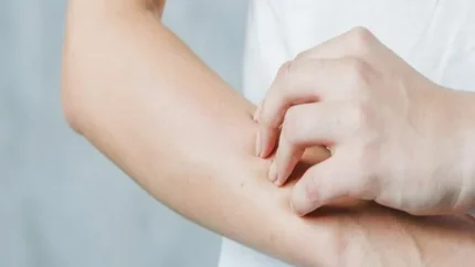 علت خارش بدن در شب