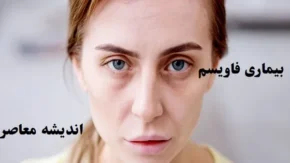 بیماری فاویسم