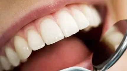 راهنمای مراقبت از دندان‌ها هنگام روزه گرفتن؛ پیشگیری از پوسیدگی و بوی بد دهان / سلامت دهان در رمضان؛ نکات کلیدی برای حفظ دندان‌ها و لثه‌ها در طول روزه‌داری