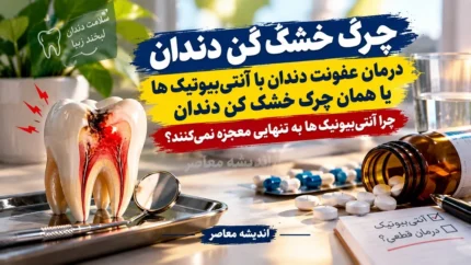 چرک خشک کن دندان | درمان عفونت دندان با آنتی‌ بیوتیک‌ ها یا همان چرک خشک کن دندان / چرا آنتی‌ بیوتیک‌ ها به تنهایی معجزه نمی‌کنند؟